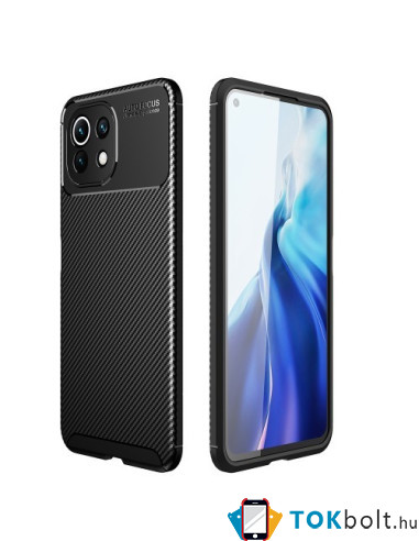 Xiaomi Mi 11 Lite karbon mintás tok - FEKETE