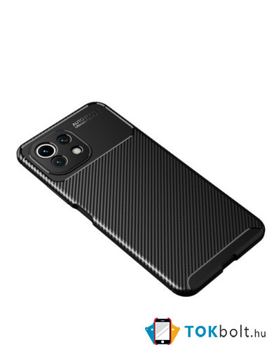 Xiaomi Mi 11 Lite karbon mintás tok - FEKETE
