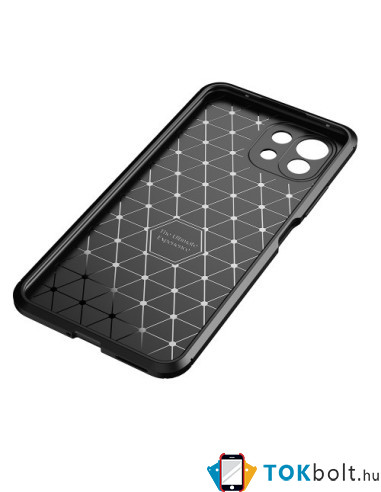Xiaomi Mi 11 Lite karbon mintás tok - FEKETE