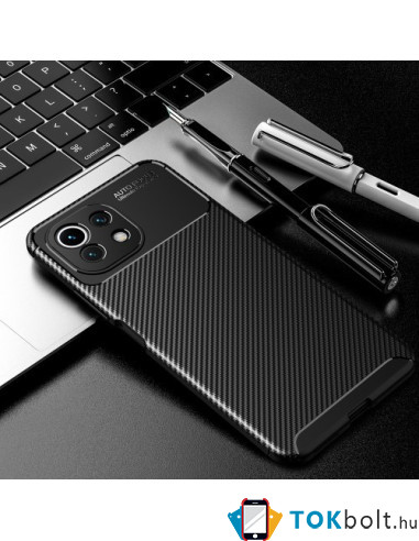 Xiaomi Mi 11 Lite karbon mintás tok - FEKETE
